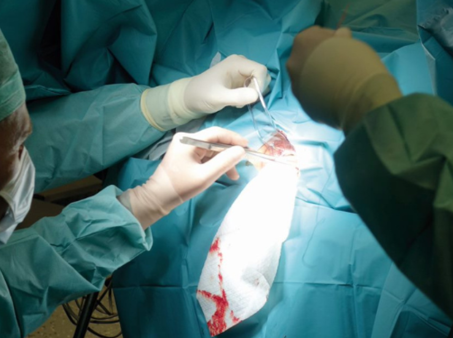 Metoda operační léčby karcinomu rekta TaTME
