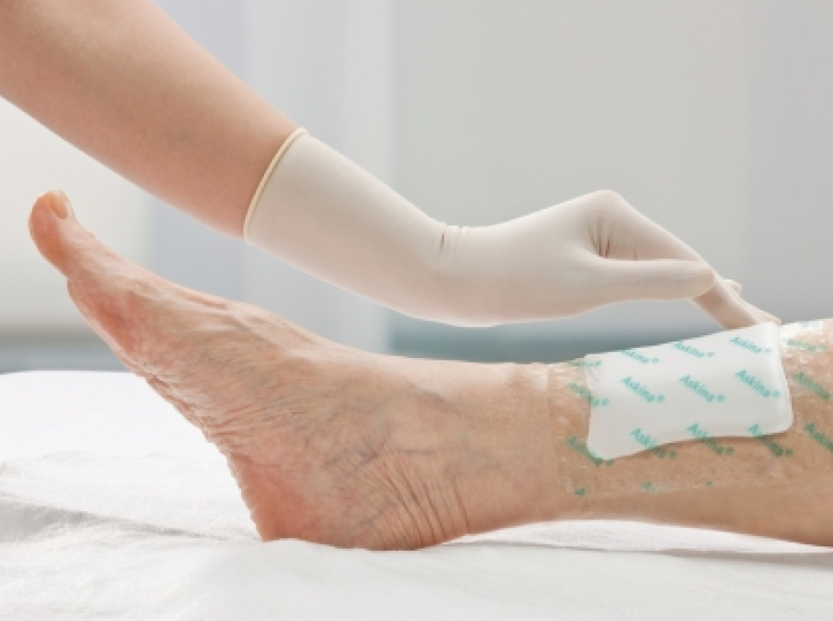 Hojení ran v odborných ambulancích hojení ran B. Braun Plus