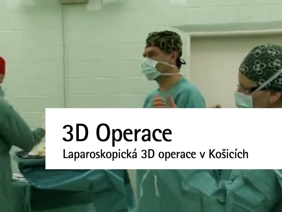 3D laparoskopická operácia v Košiciach