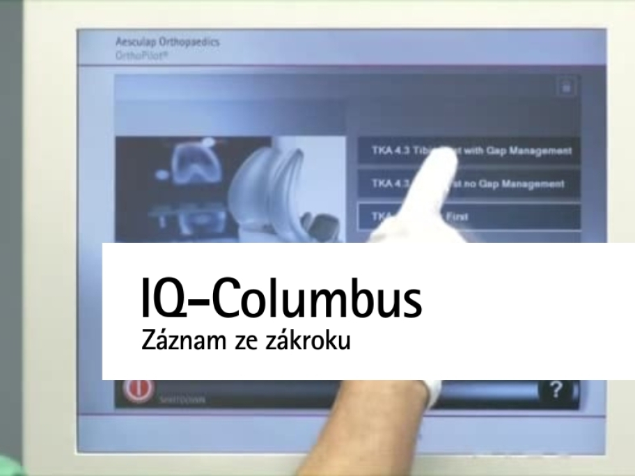 Výměna kolenního kloubu