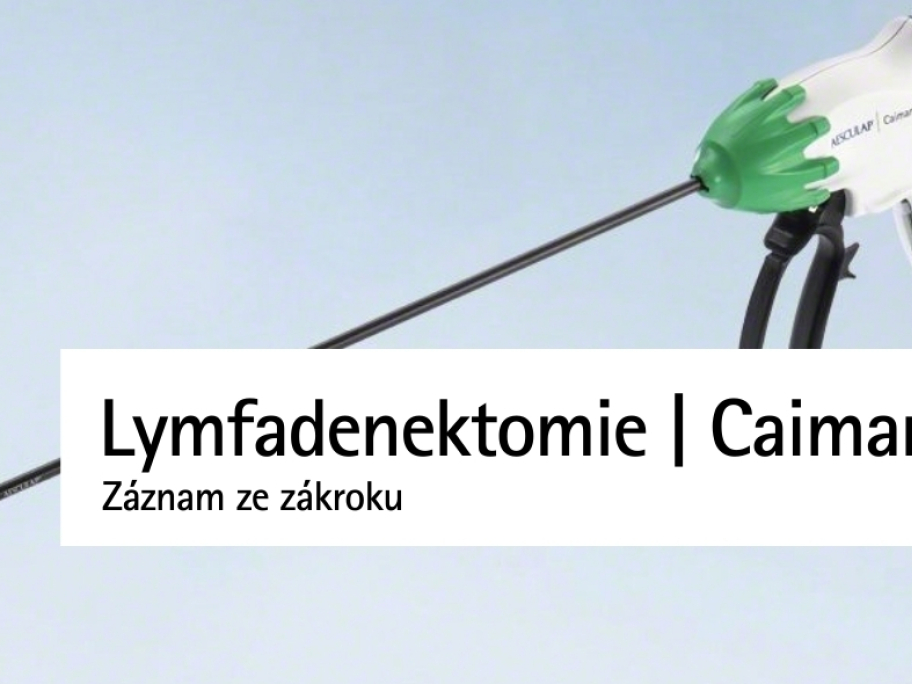 Rozšířená ilio-obturatis lymfadenektomie