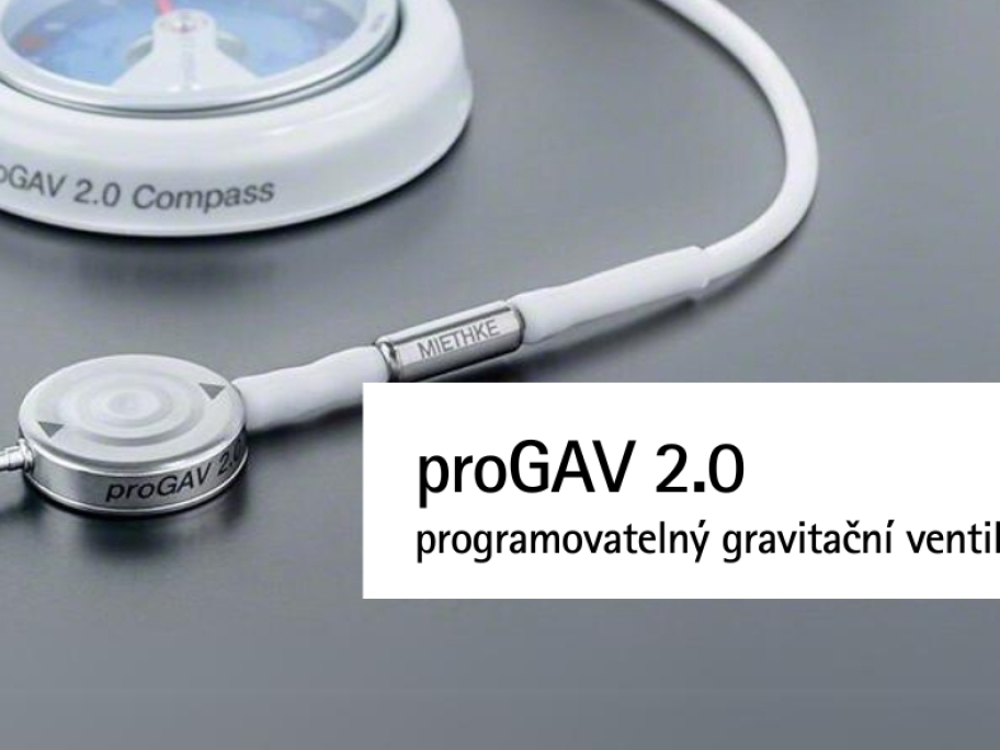 proGAV 2.0 programovatelný gravitační ventil