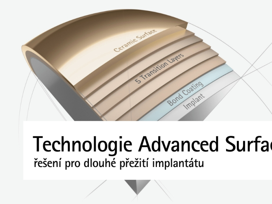 Technologie Advanced Surface | Řešení pro dlouhé přežití implantátu