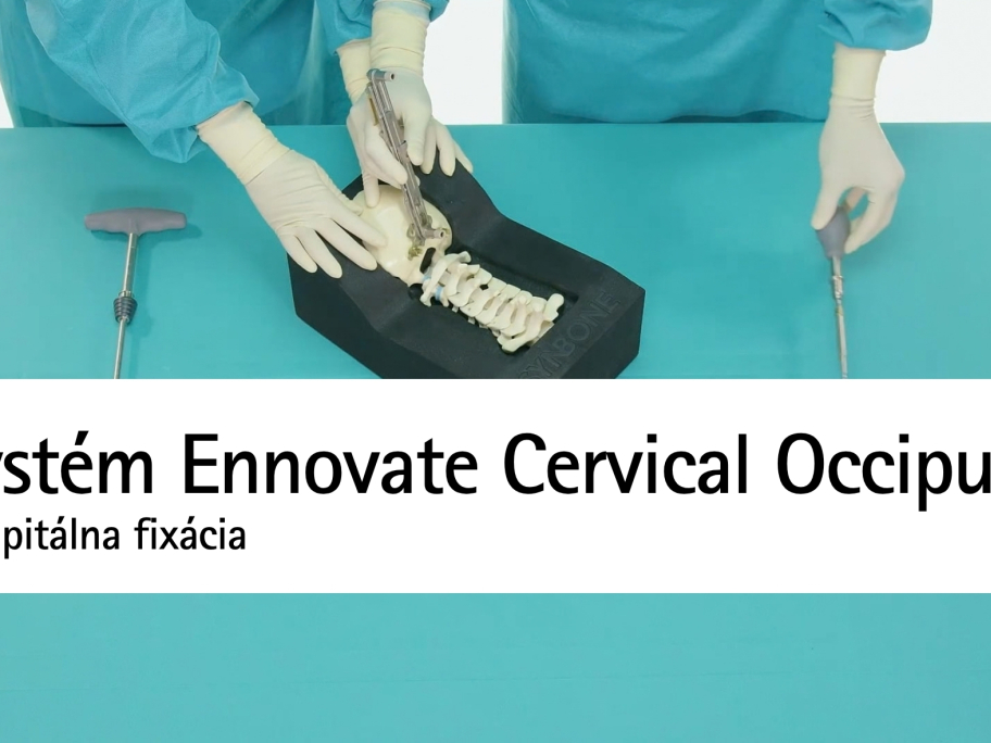 Okcipitálna fixácia systémom Ennovate Cervical Occiput