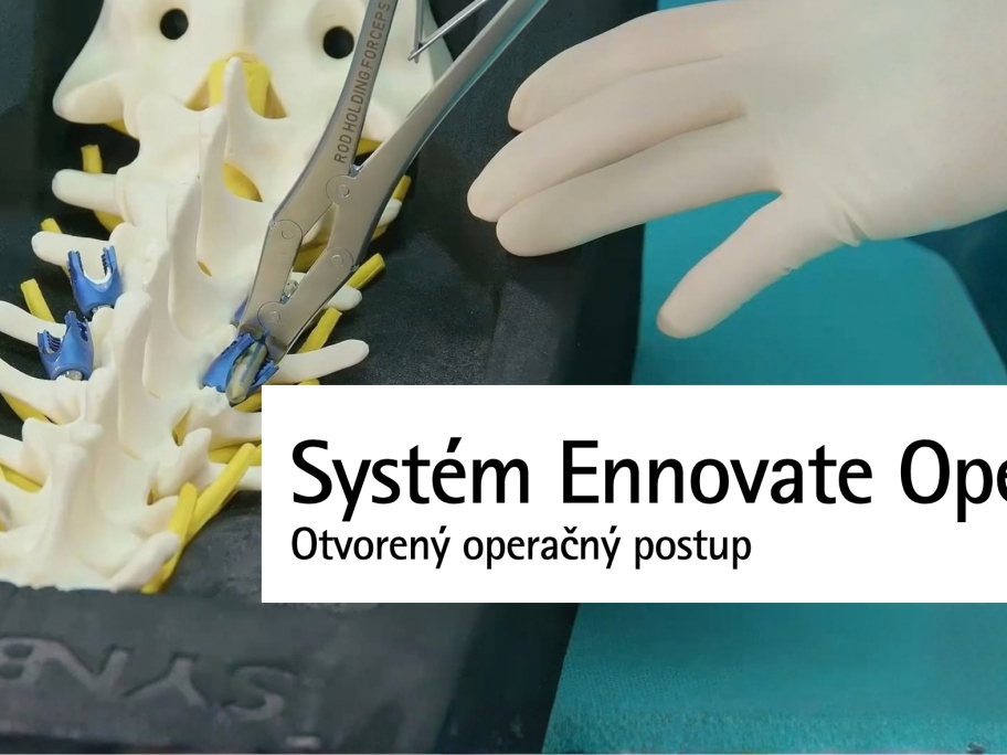 Otvorený operačný postup systémom Ennovate Open