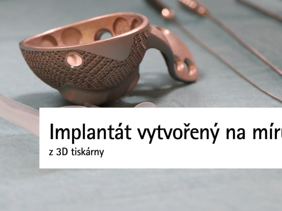 Implantát vytvořený na míru z 3D tiskárny