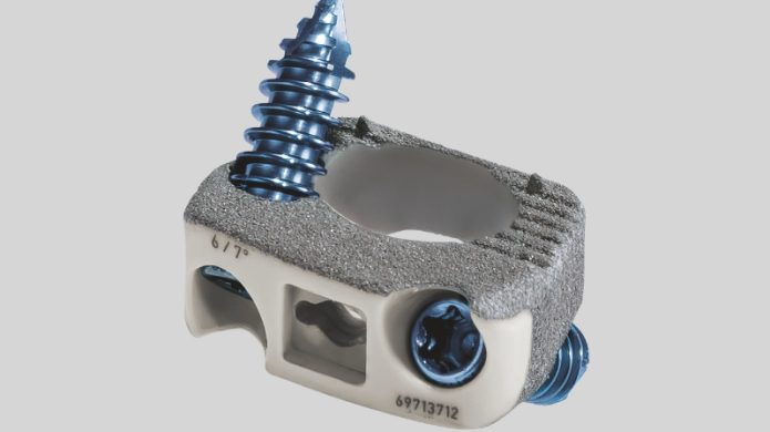 ArcadiusXP C® – Krční implantát, který sám drží a zároveň podporuje růst