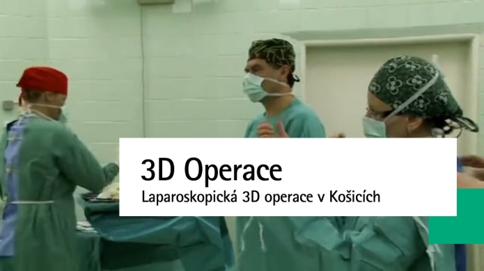 3D laparoskopická operácia v Košiciach
