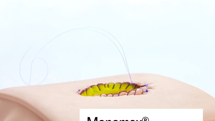 Monomax® chirurgické šití Aesculap