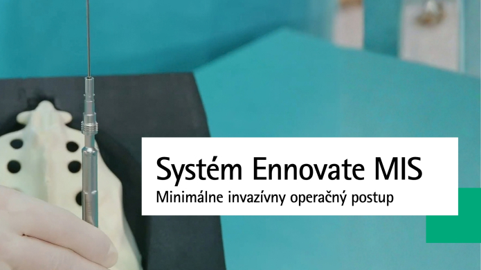 Minimálne invazívny operačný postup systémom Ennovate MIS