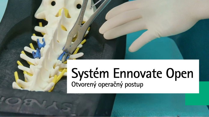Otvorený operačný postup systémom Ennovate Open