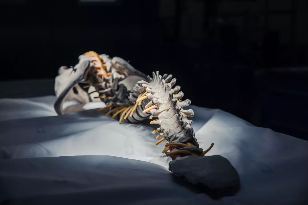 Vize české spondylochirurgie 