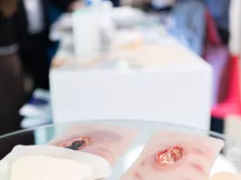 Účastníci se mohli podívat na prototyp dekubitů v různých fázích