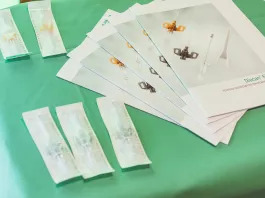 Diacan Flex inovatívny systém pre kanylovanie AV fistuly, navrhnutý pre maximálnu bezpečnosť a jednoduchú manipuláciu