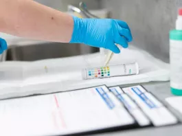 Vyšetření moči zaměřené na detekci časných ukazatelů onemocnění ledvin. 