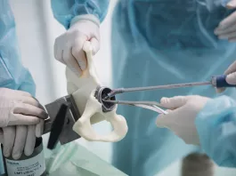 Kurz Aesculap Academy | Primárí a revizní endoprotetika kyčle