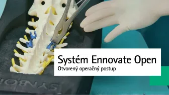 Otvorený operačný postup systémom Ennovate Open