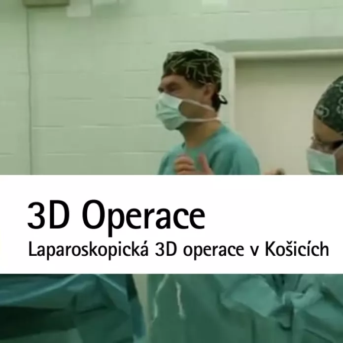 3D laparoskopická operácia v Košiciach