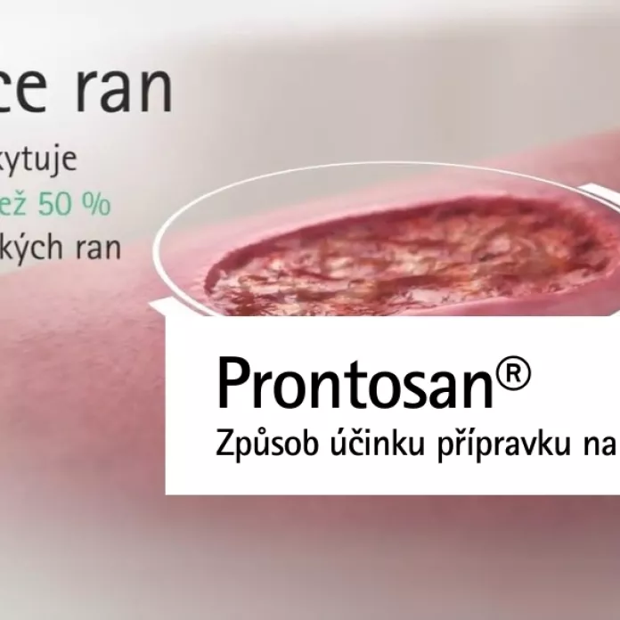 Prontosan - způsob účinku přípravku na hojení ran