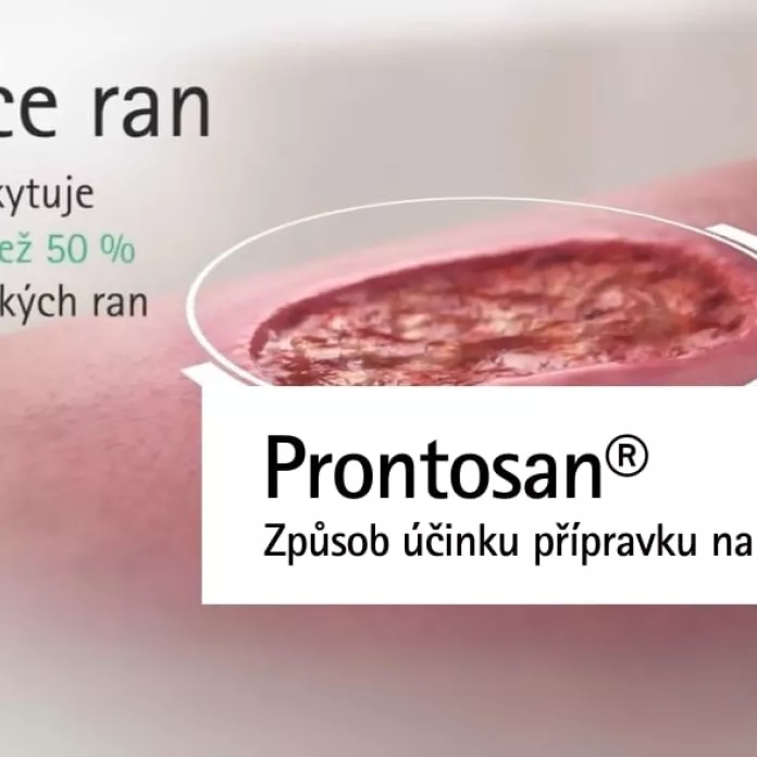 Způsob účinku přípravku na hojení ran Prontosan