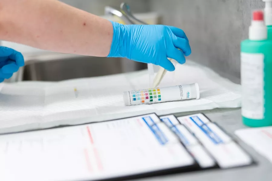 Vyšetření moči zaměřené na detekci časných ukazatelů onemocnění ledvin. 